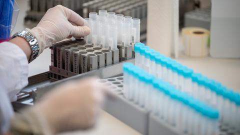 Teströhrchen für PCR-Tests in einem Labor (dpa)