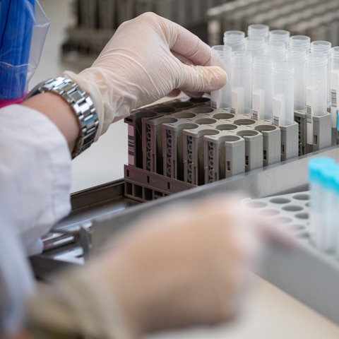 Teströhrchen für PCR-Tests in einem Labor (dpa)