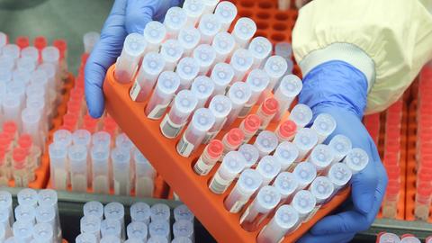 Teströhrchen für PCR-Tests in einem Labor (dpa)