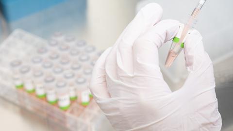 Eine biologisch-technische Assistentin im Niedersächsischen Landesgesundheitsamt bereitet PCR-Tests auf das Corona-Virus von Patienten für die Analyse vor. (dpa)
